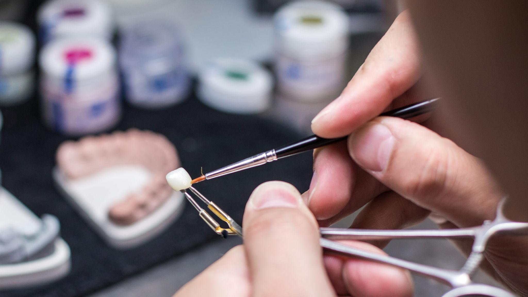 dental lab zirconia crowns model